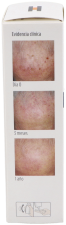 Eryfotona AK NMSC Fluid SPF 100+ 50 ml